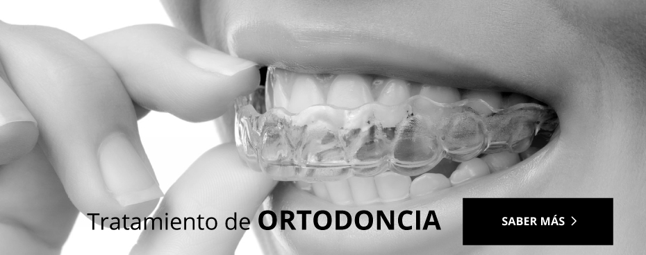 Ortodoncia Orihuela